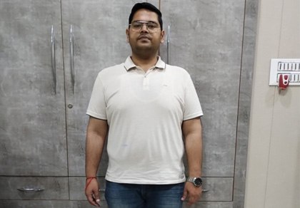 Anshul's photo after bariatric surgery